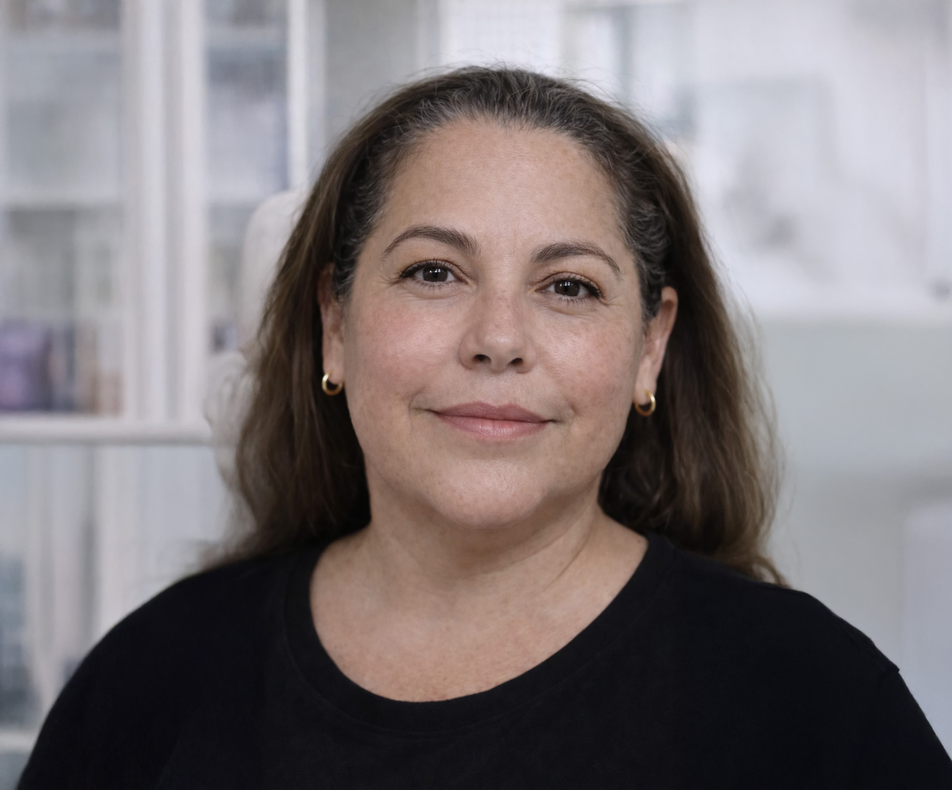 Treatment image for HarmonyCa® (Hyaluronic Acid + Calcium Hydroxyapatite)