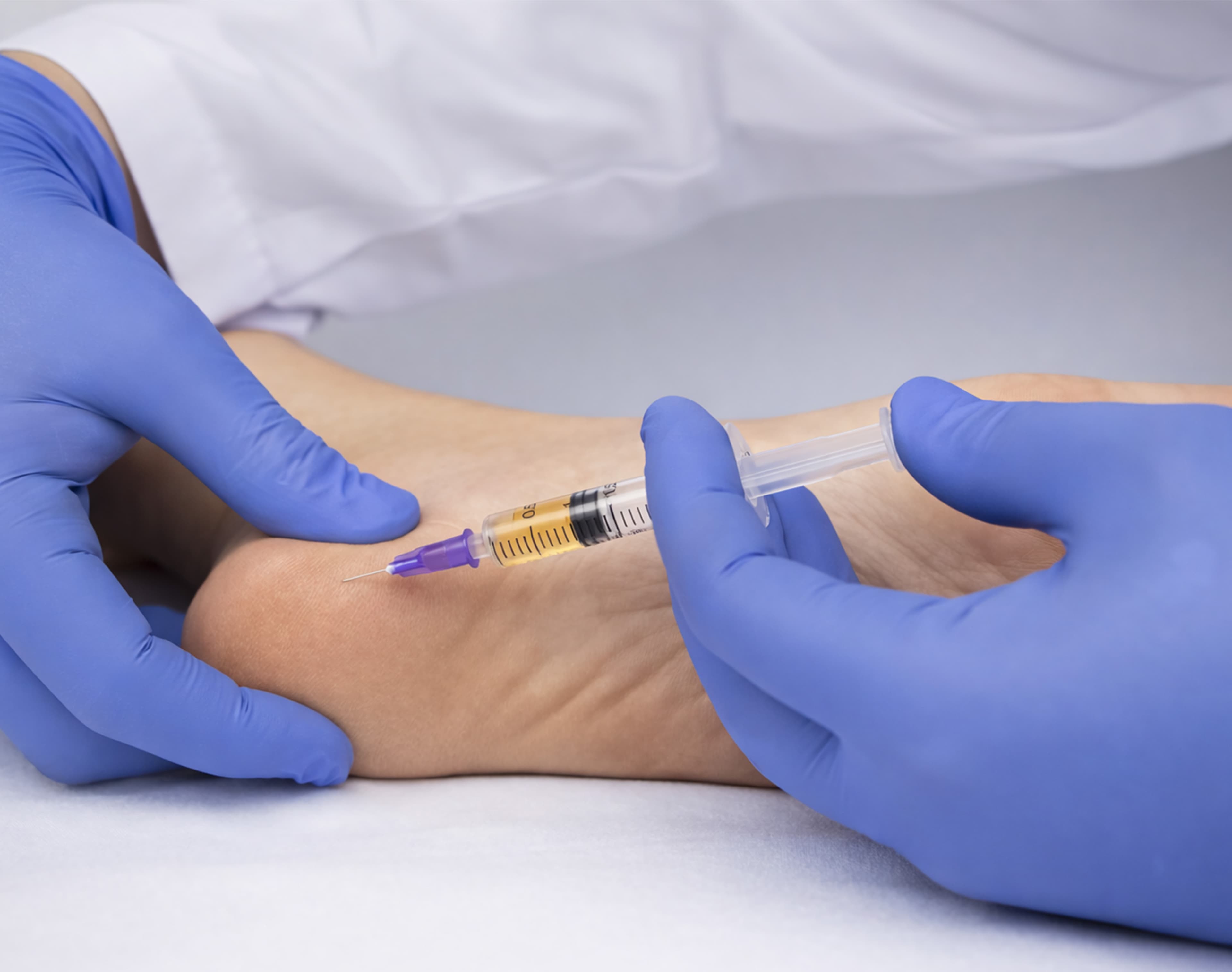 Heel Spur Injection (Calcaneal Spur) – Targeted injection therapy to reduce inflammation and pain caused by calcaneal spurs and plantar fasciitis.