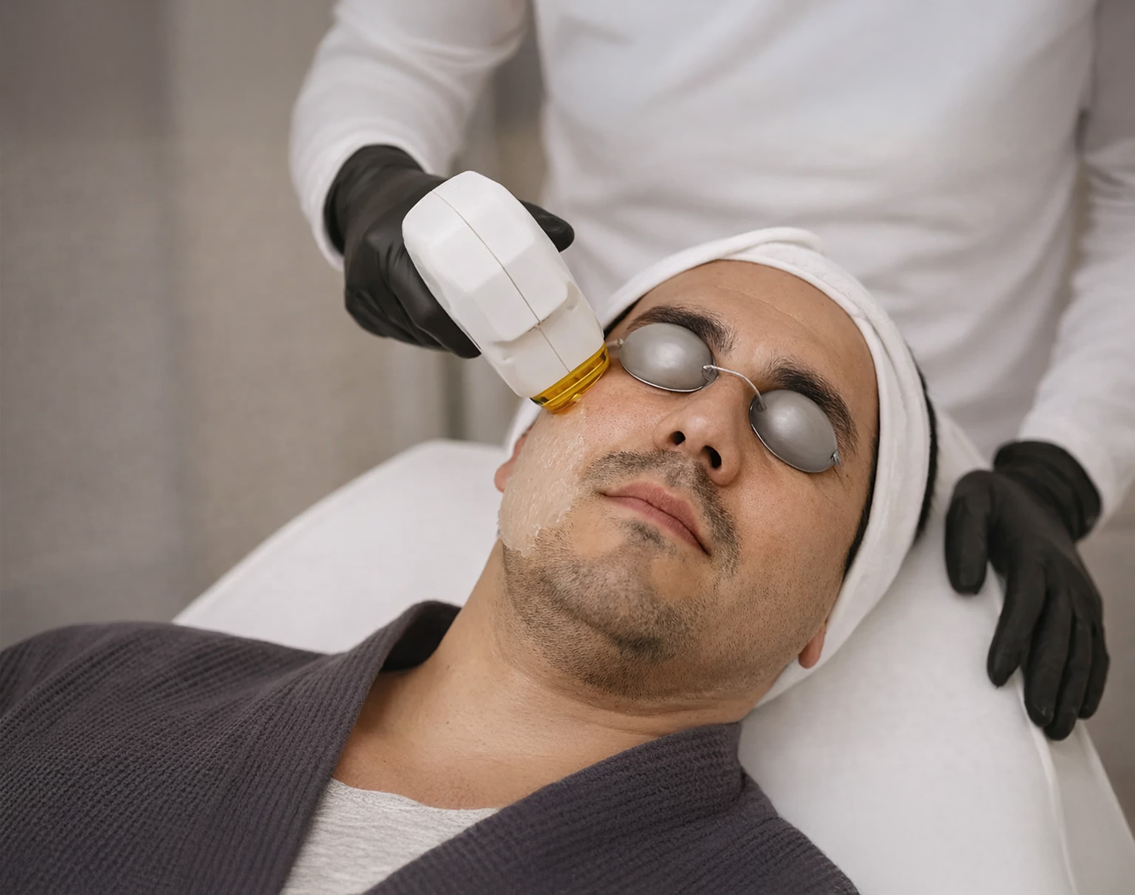 IPL Photofacial (Harmony XL)