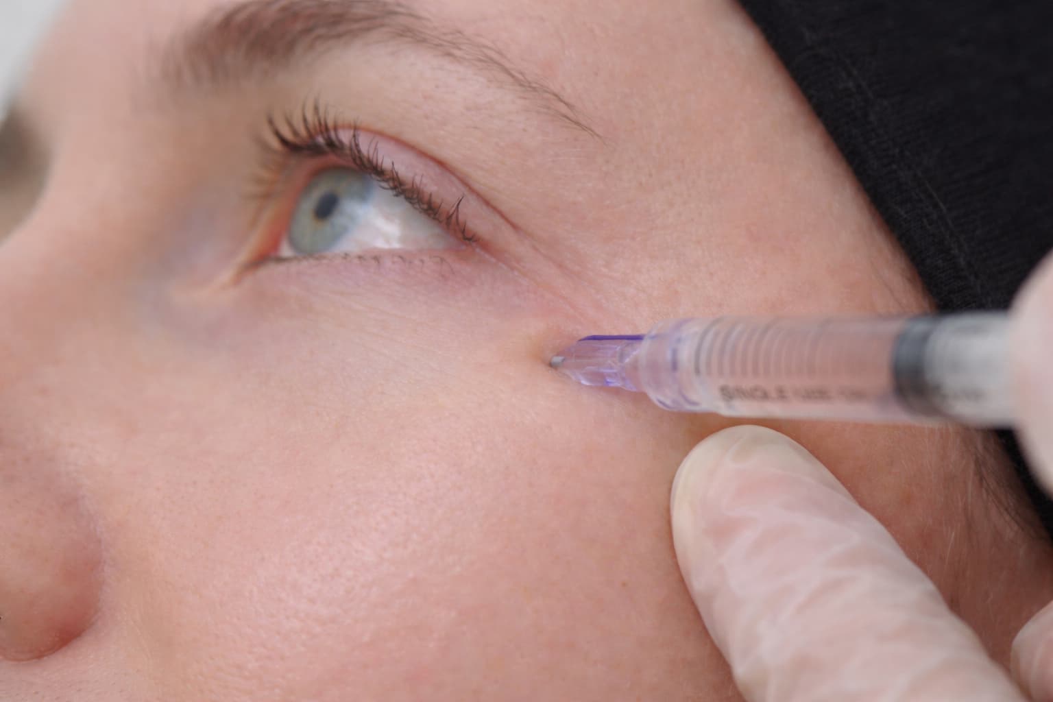 French Bio-Revitalization Therapy