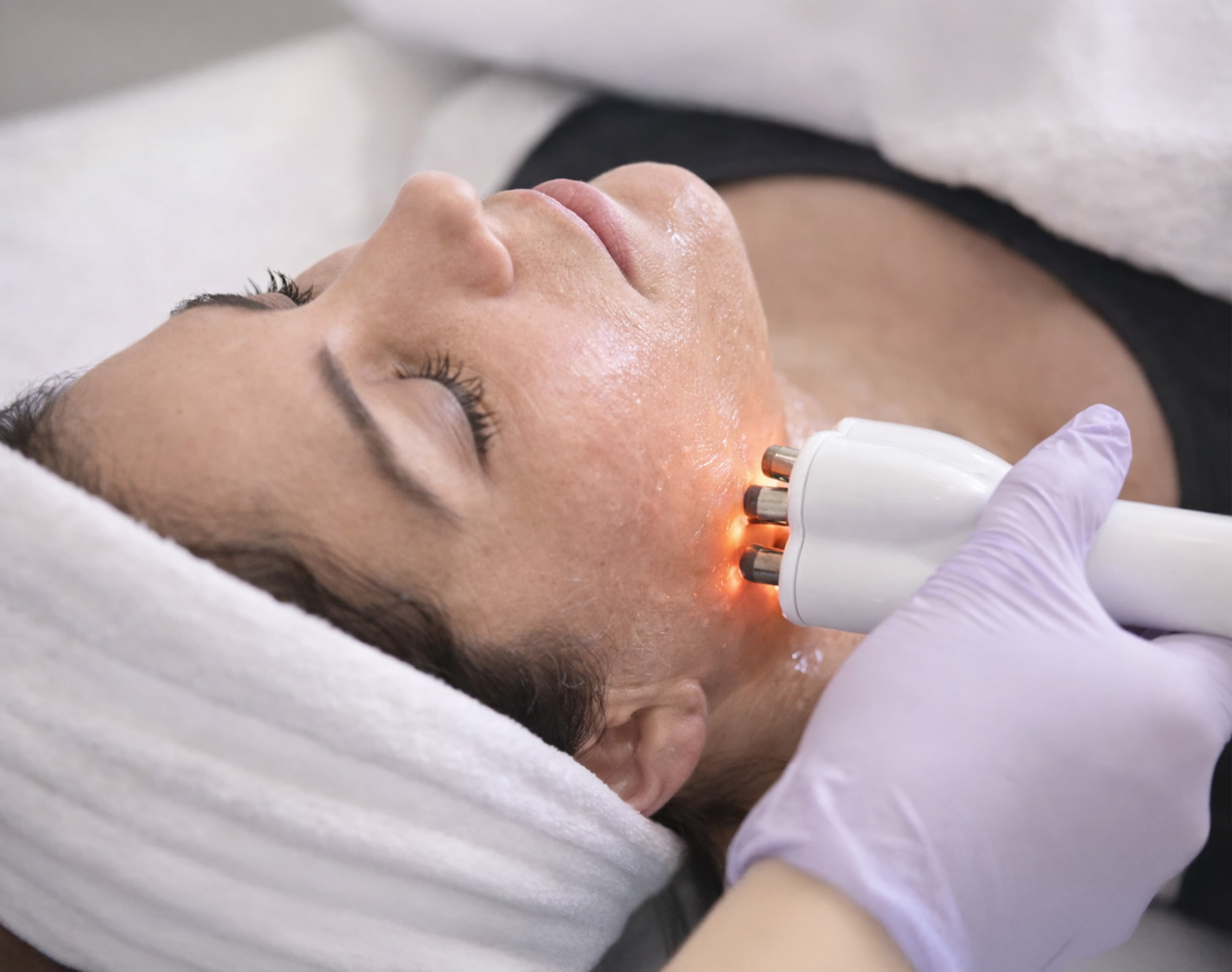 Treatment image for Radiofrequency Body Sculpting