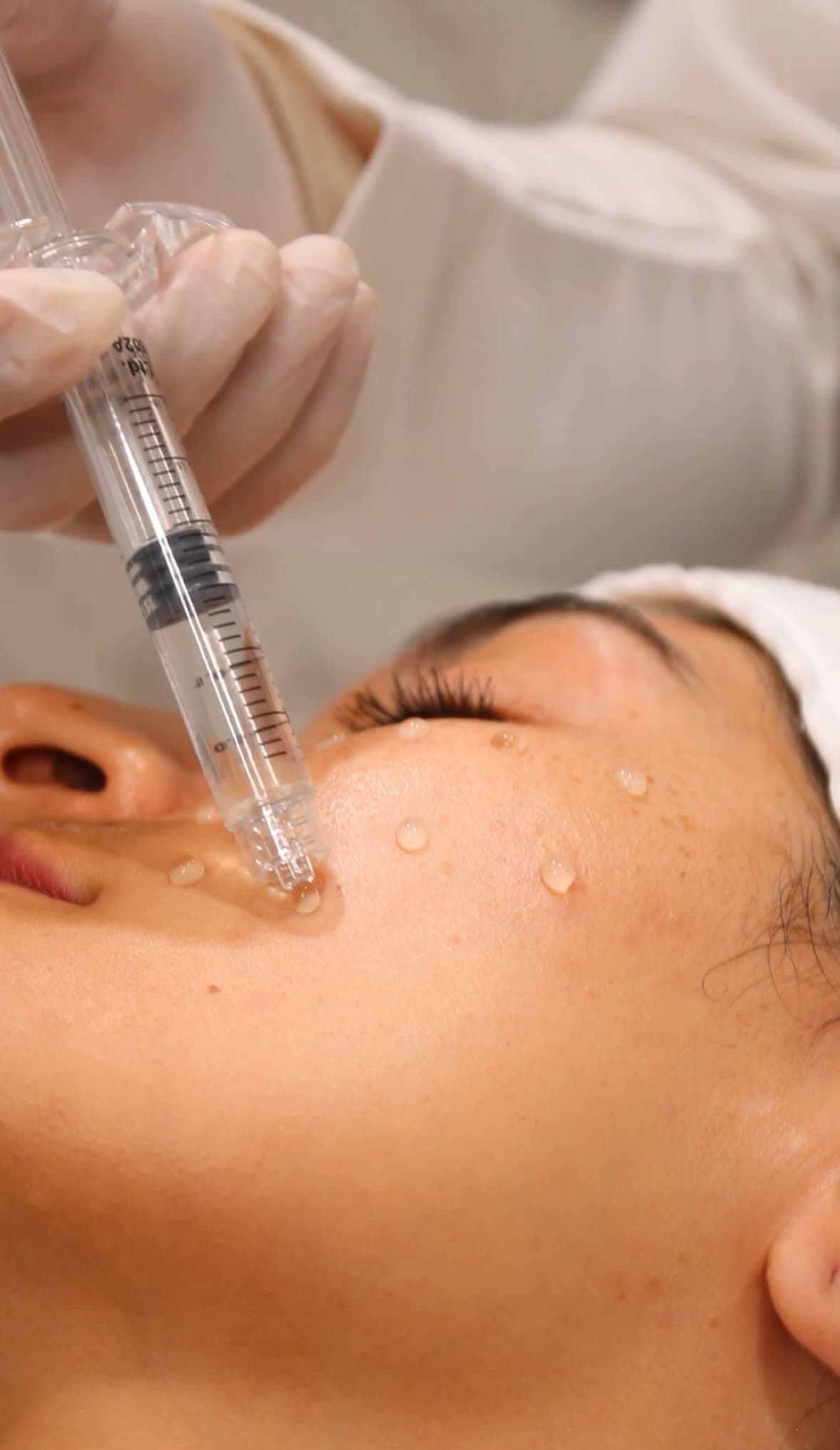 Treatment image for Serum Add-Ons (PRP, PN, PDRN)