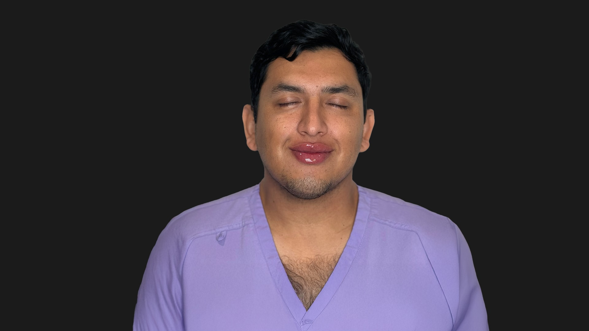 Lip Rejuvenation & Sculpting After