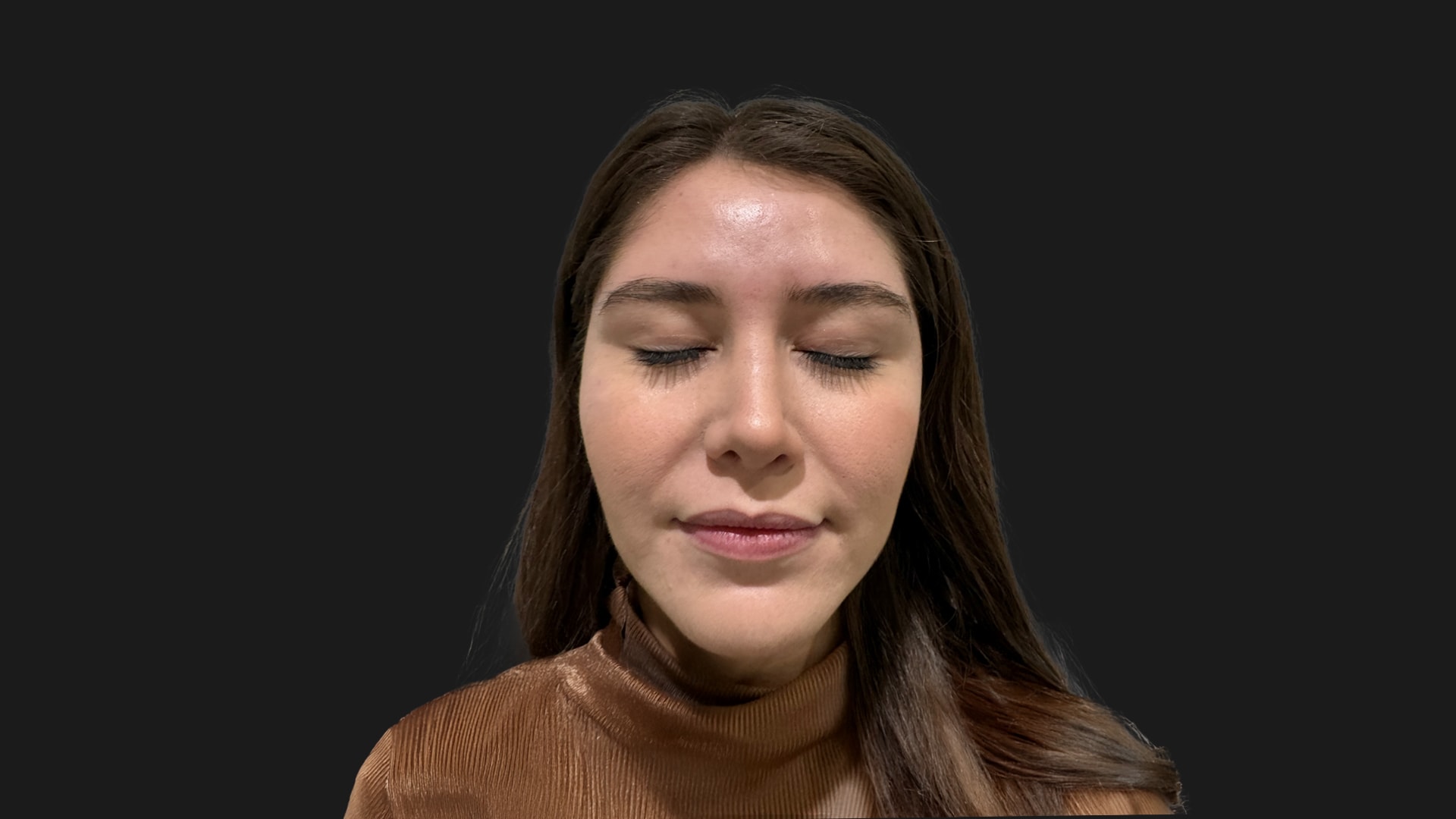 Lip Rejuvenation & Sculpting Before