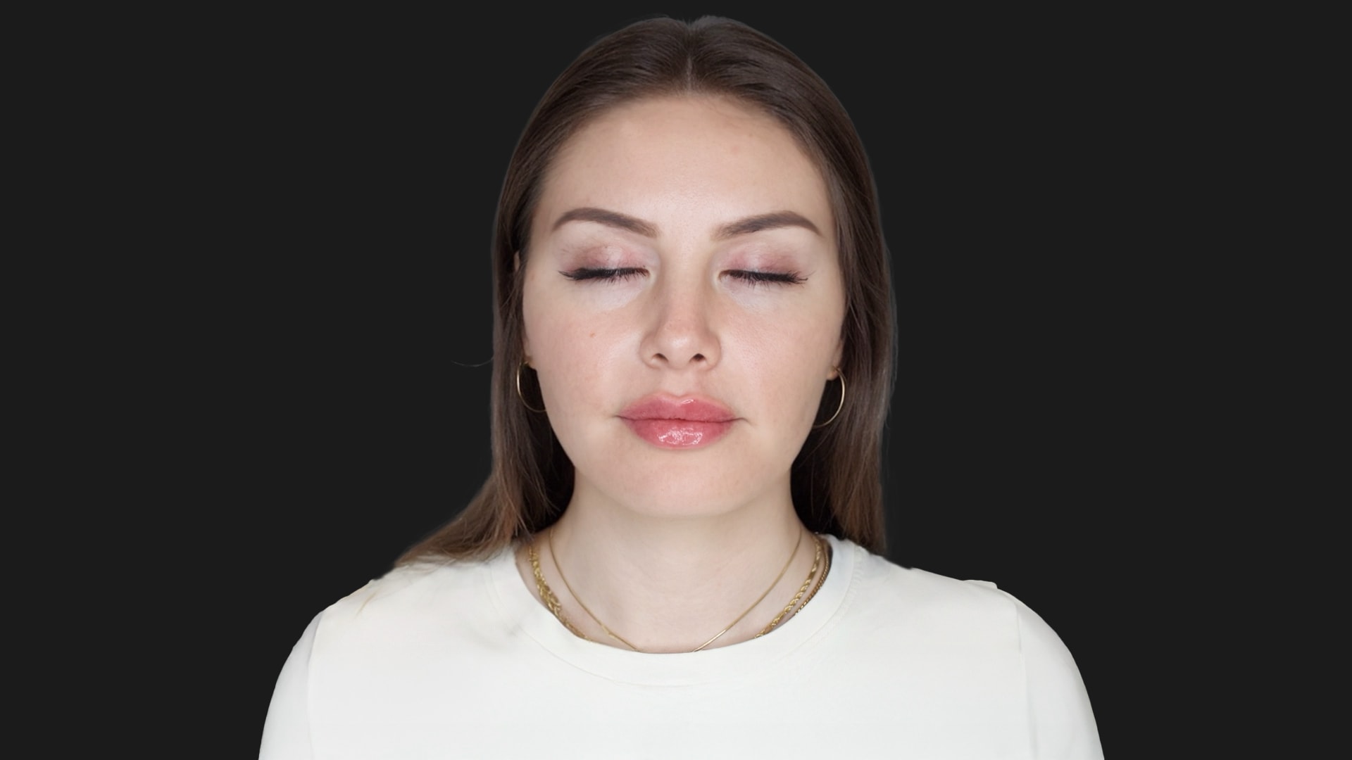 Lip Rejuvenation & Sculpting After