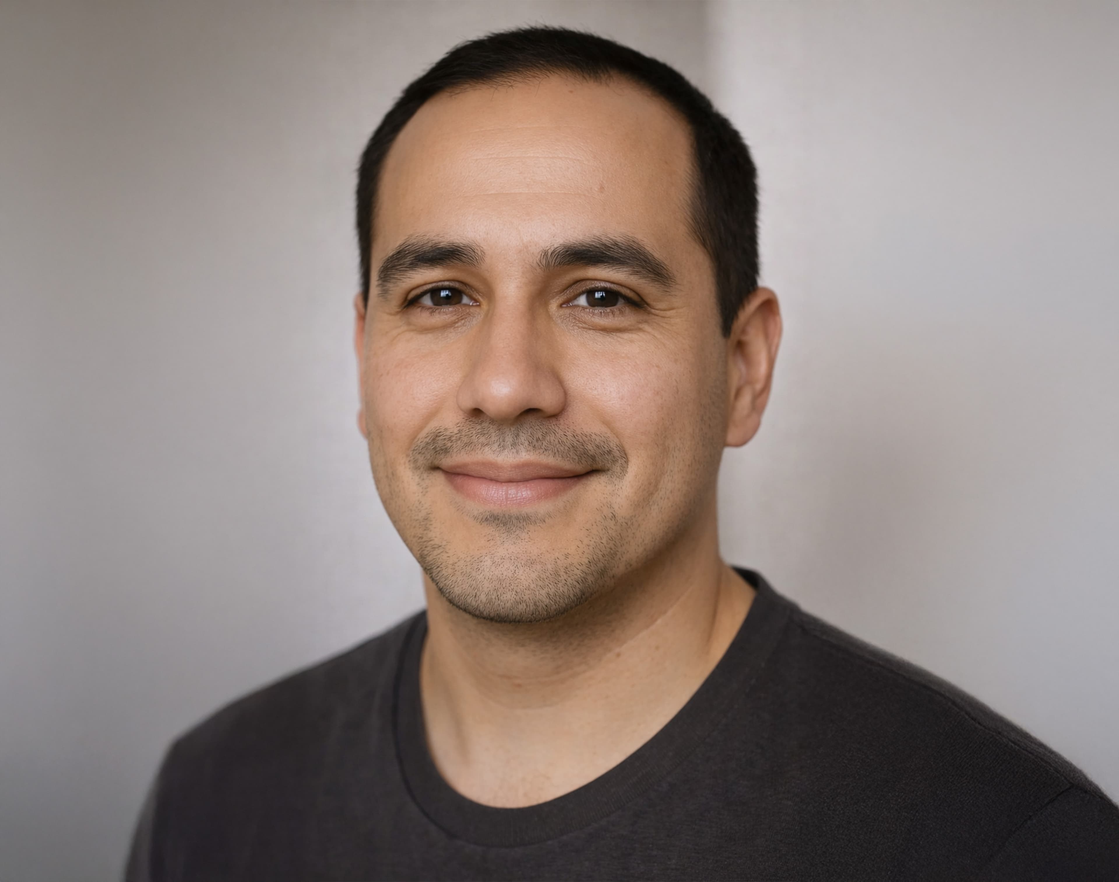 Treatment image for IPL Photofacial (Harmony XL)